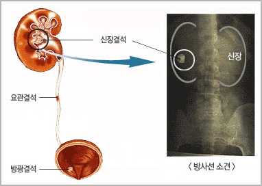 위치별 결석사진