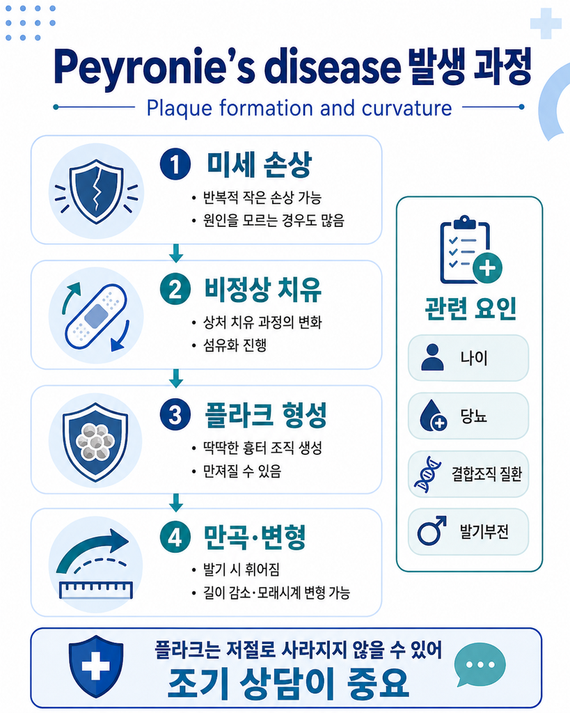 음경만곡증 치료, Peyronie’s disease 수술 교정 전에 알아야 할 것 4 ChatGPT Image 2026년 8월 23일 오후 02 37 01 3