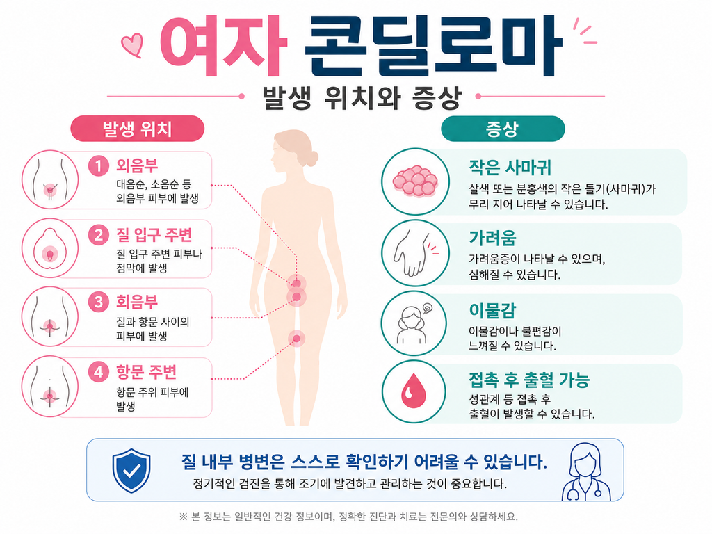 콘딜로마 남자·여자 증상, 원인부터 치료·전염까지 총정리 5 콘딜로마 남자·여자 증상, 원인부터 치료·전염까지 총정리